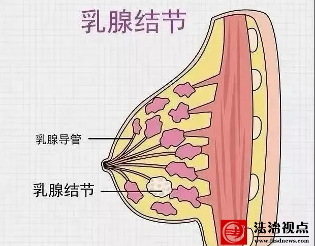 滨医附院：乳腺增生、乳腺结节注意事项